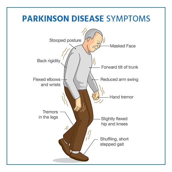 photo of Parkinson's Disease