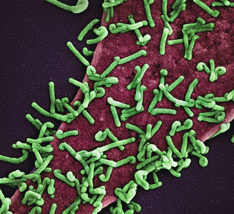 a close up of a cell with green algae